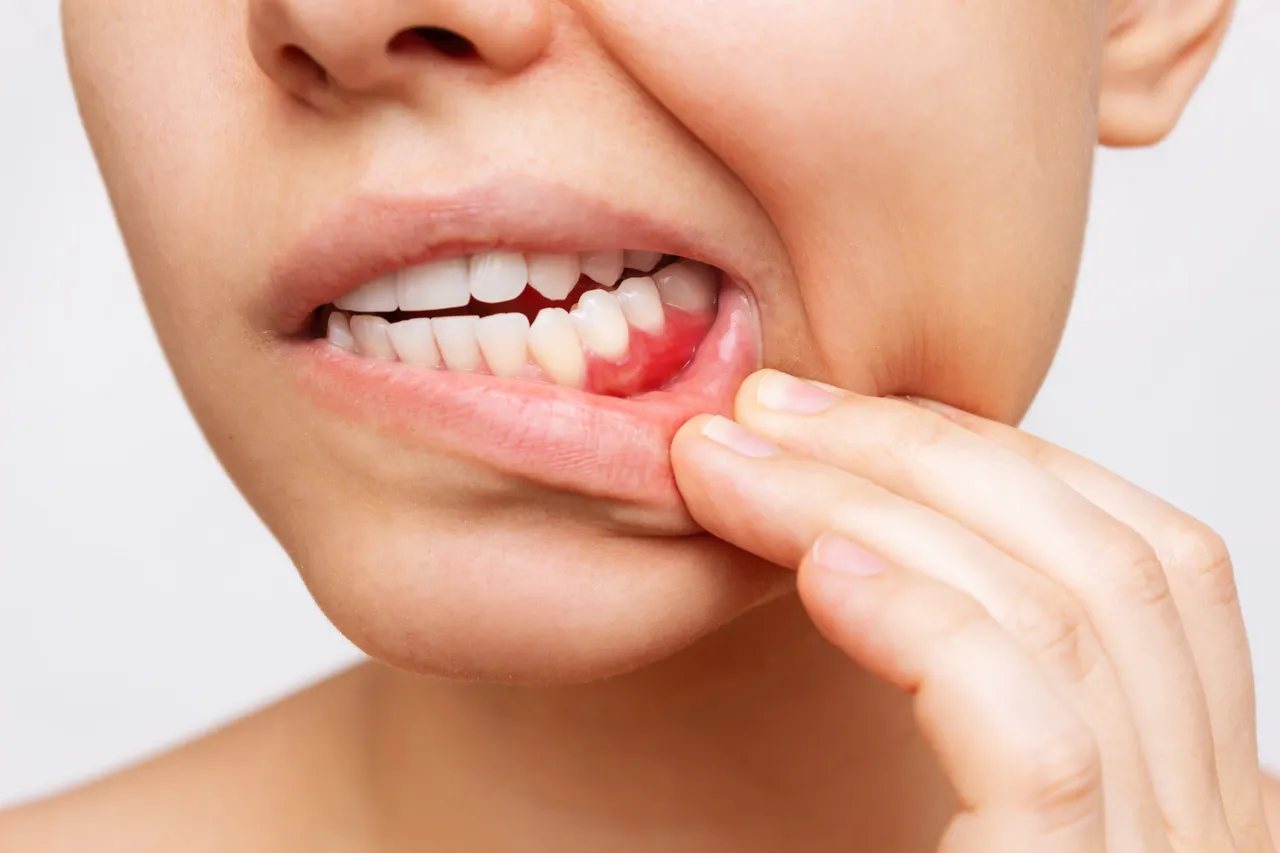 Periodontal Maintenance in Somerset, NJ | Long-Term Gum Health Starts Here